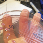 This may be the grossest eye pic ever—but the cause is what’s truly horrifying