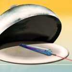 Does the weight-loss revolution show up in the data?