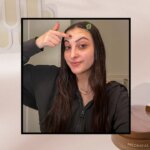 9 Best Wrinkle Patches That Actually Smooth Fine Lines 2026