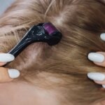 How to Use a Derma Roller for Hair Growth, According to Scalp Experts
