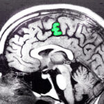 British politicians have the wrong kind of money on the brain