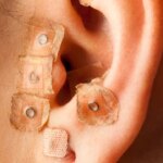 What Exactly Is Ear Seeding? How the Acupressure Therapy Helped Provide Me With Energy and Focus